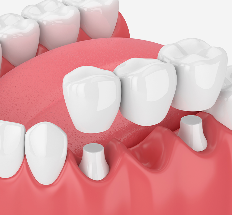 Treatment - Gloucester dental