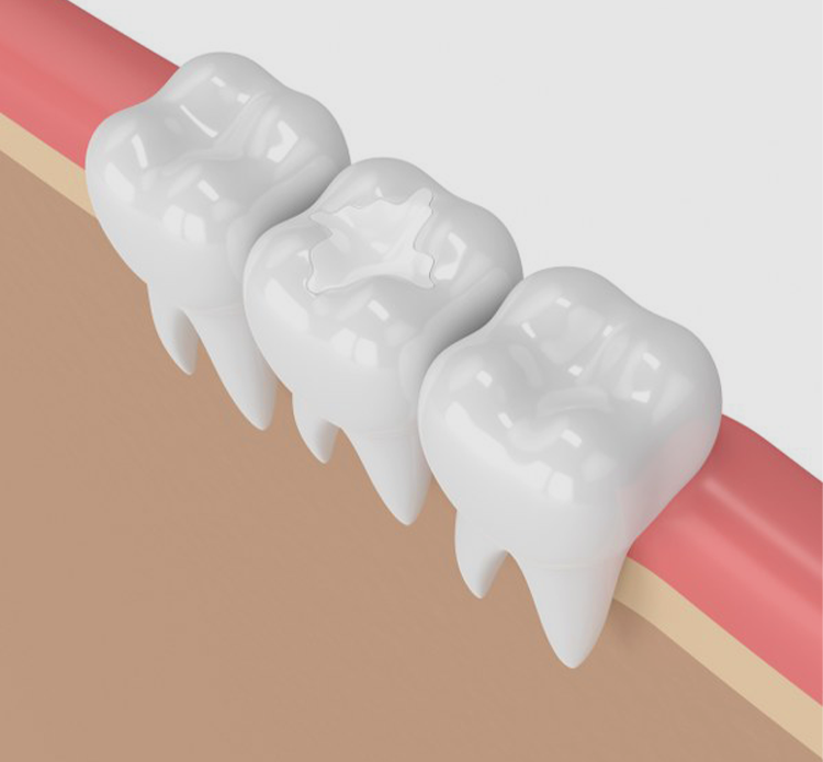 Treatment - Gloucester dental